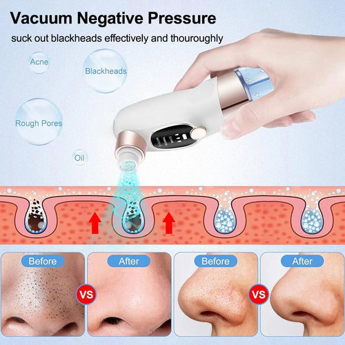 Electric Blackhead Remover Pore Vacuum Cleaner Facial Black Dots