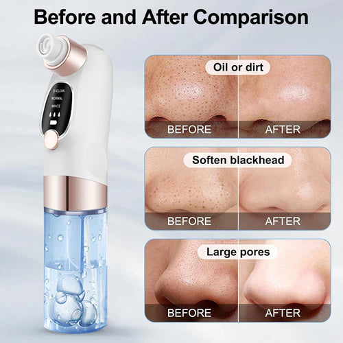 Electric Blackhead Remover Pore Vacuum Cleaner Facial Black Dots